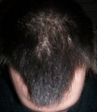 th_fronttop-1.jpg