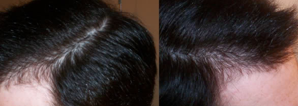 Sides3.jpg