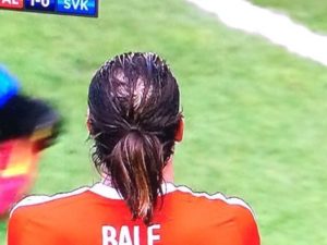 balez-300x225.jpg