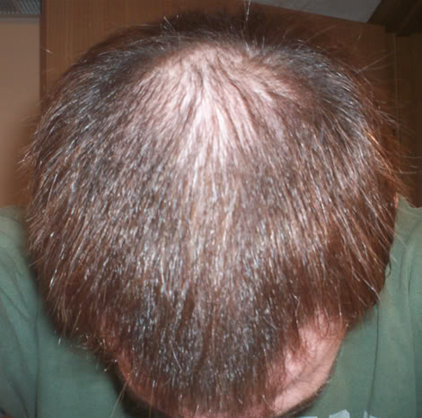 TopFront2.jpg