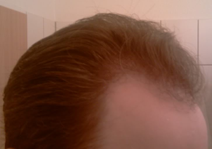 mar2011right.jpg