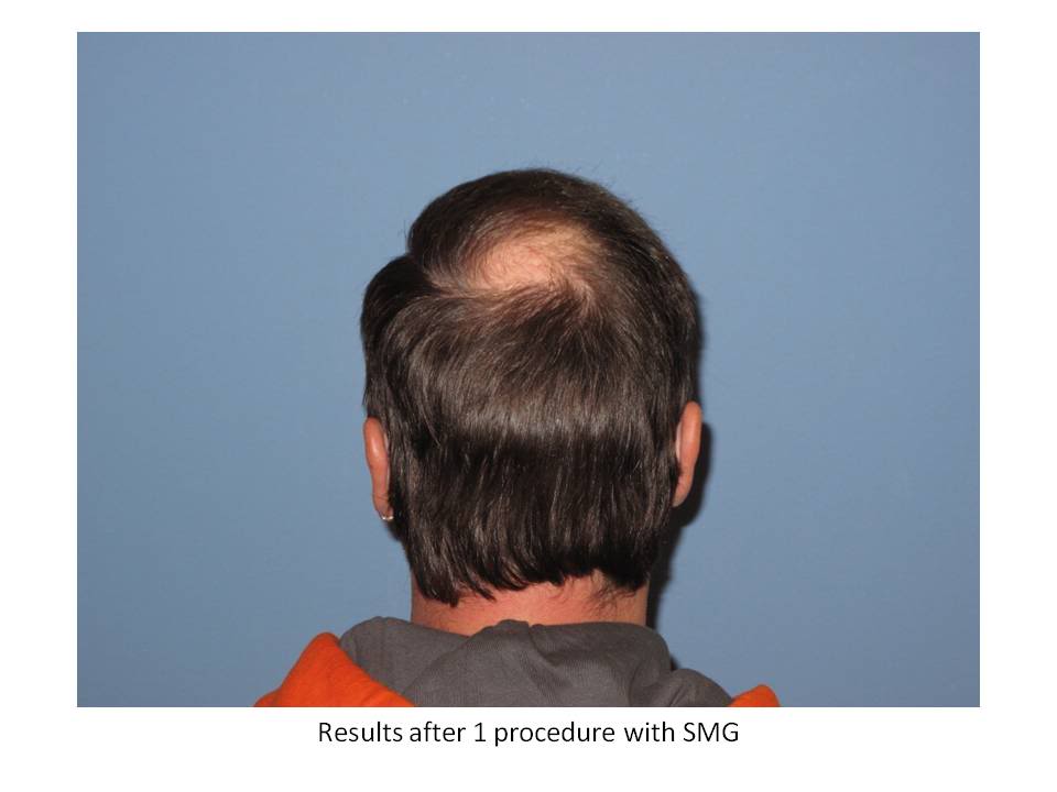 Slide8-1.jpg