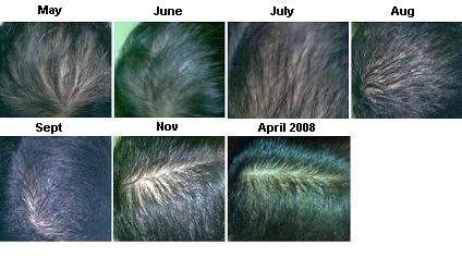 10mths_journey-1.jpg
