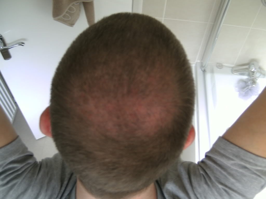 8weekspostop006.jpg