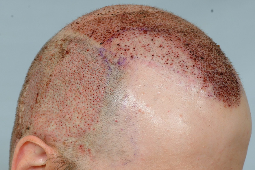 head_harvest1.jpg