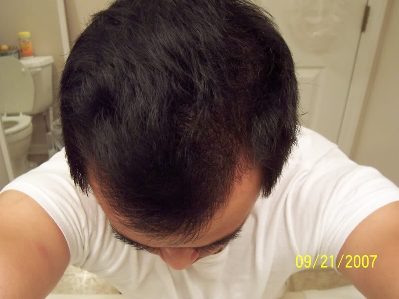 100_3024-1.jpg