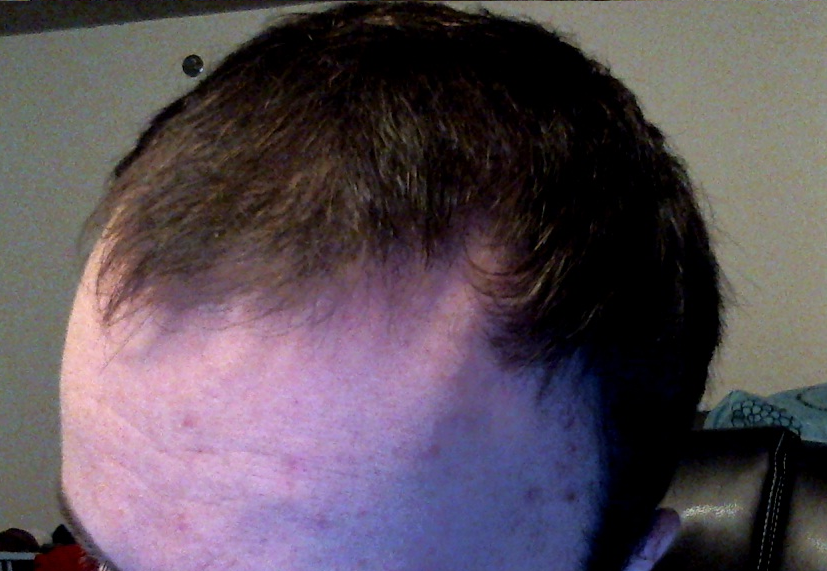 after.png