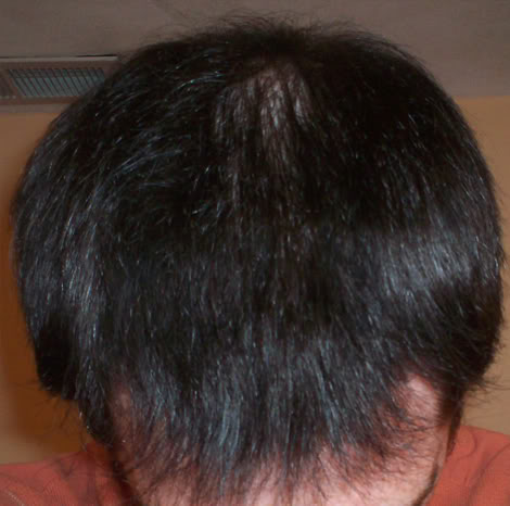 TopFront3.jpg