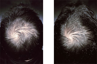 tricominhairshot.jpg