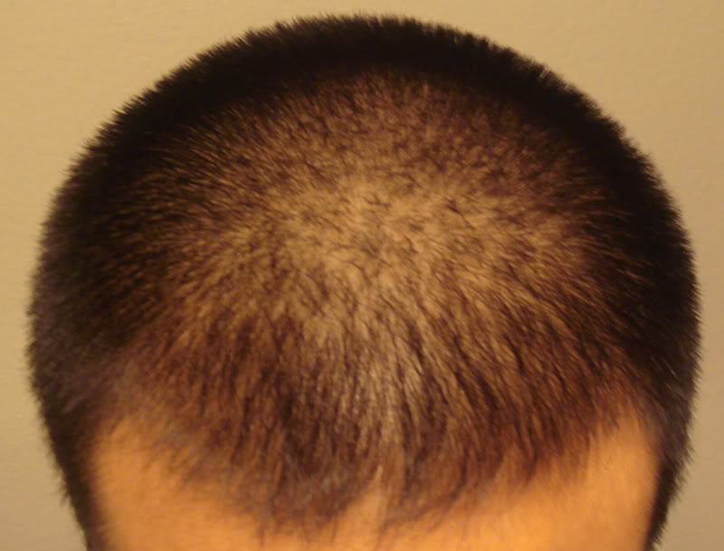 front_dry.jpg