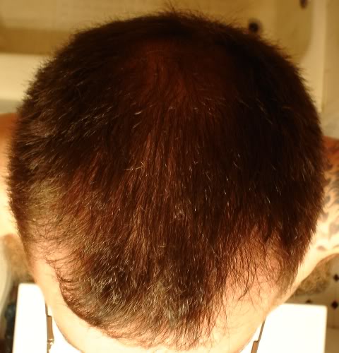 001Towel-DriedHair.jpg