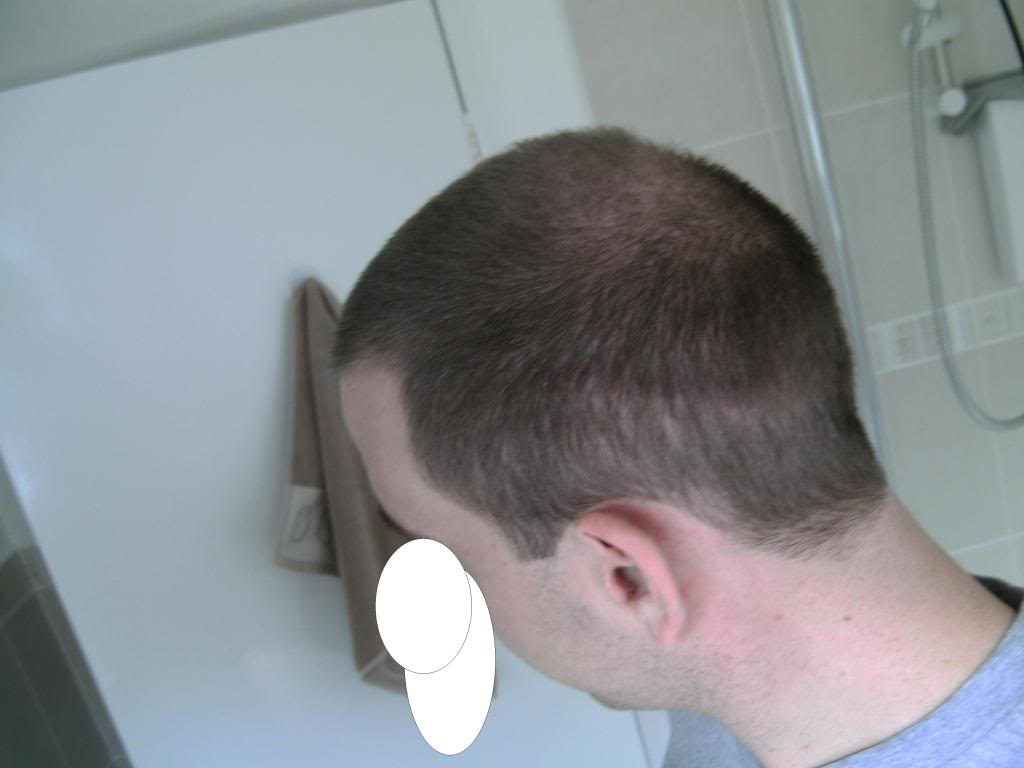8weekspostop00.jpg