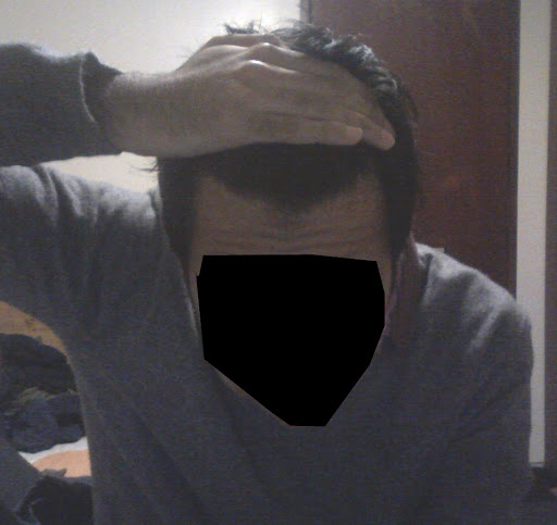 hairline2.jpg