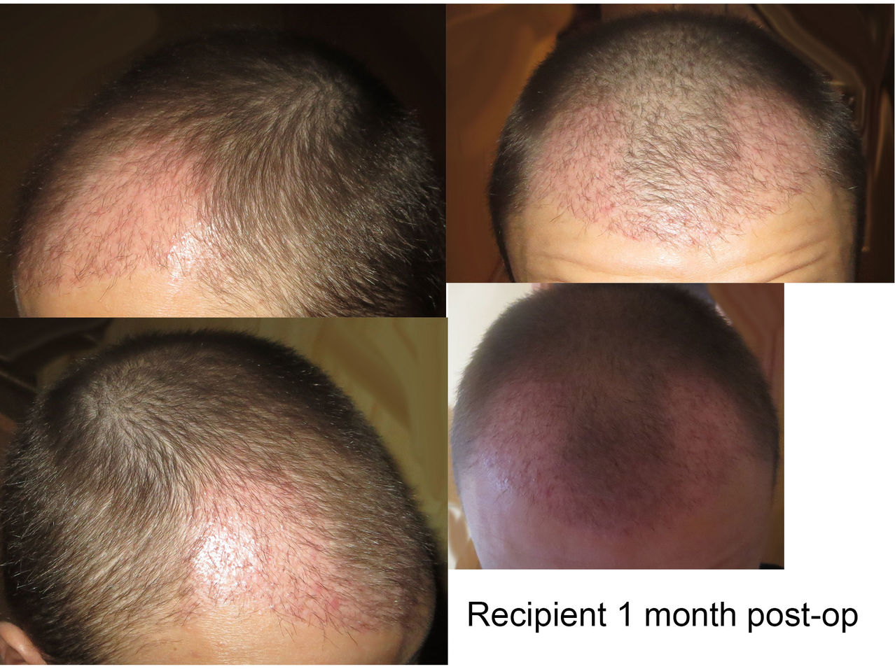 recipient1month.jpg