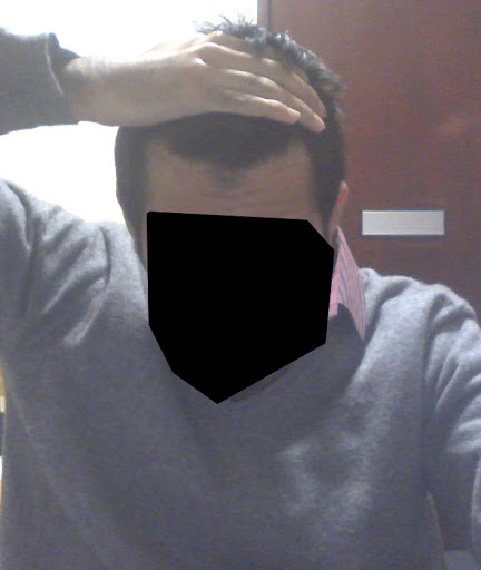 hairline3.jpg