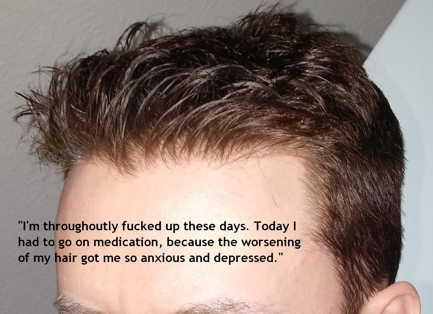 DXsMSIb.jpg