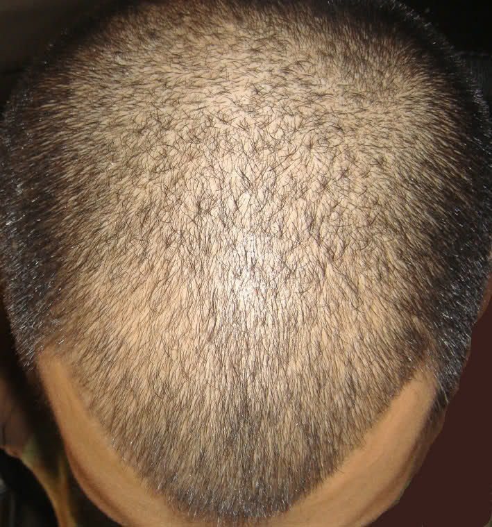 kd9083.jpg