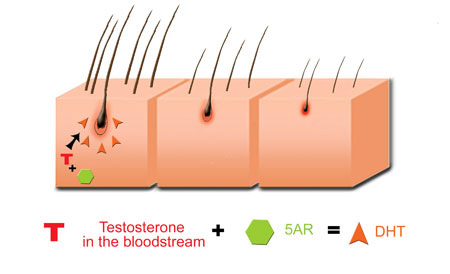 hairloss-creatine-dht.jpg