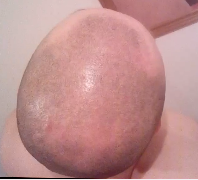Capturee.png