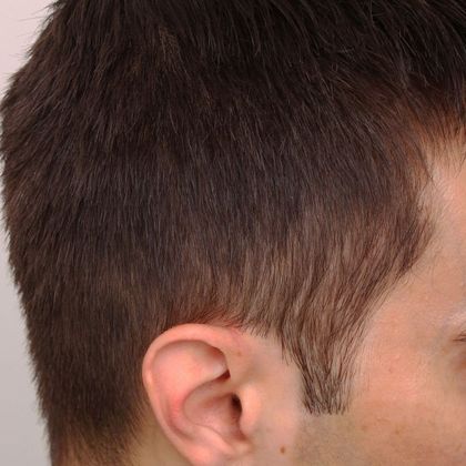 www.hairlossdoctors.com
