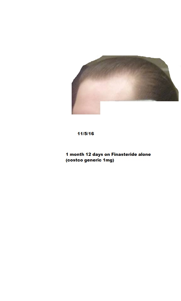 Y7Wl9nE.jpg