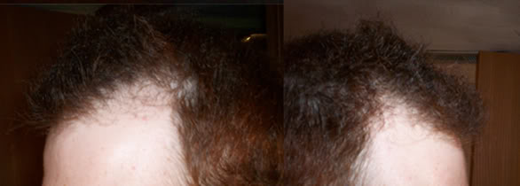 Sides1.jpg