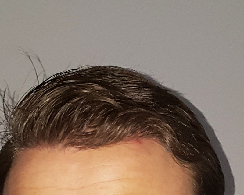 hairs.jpg