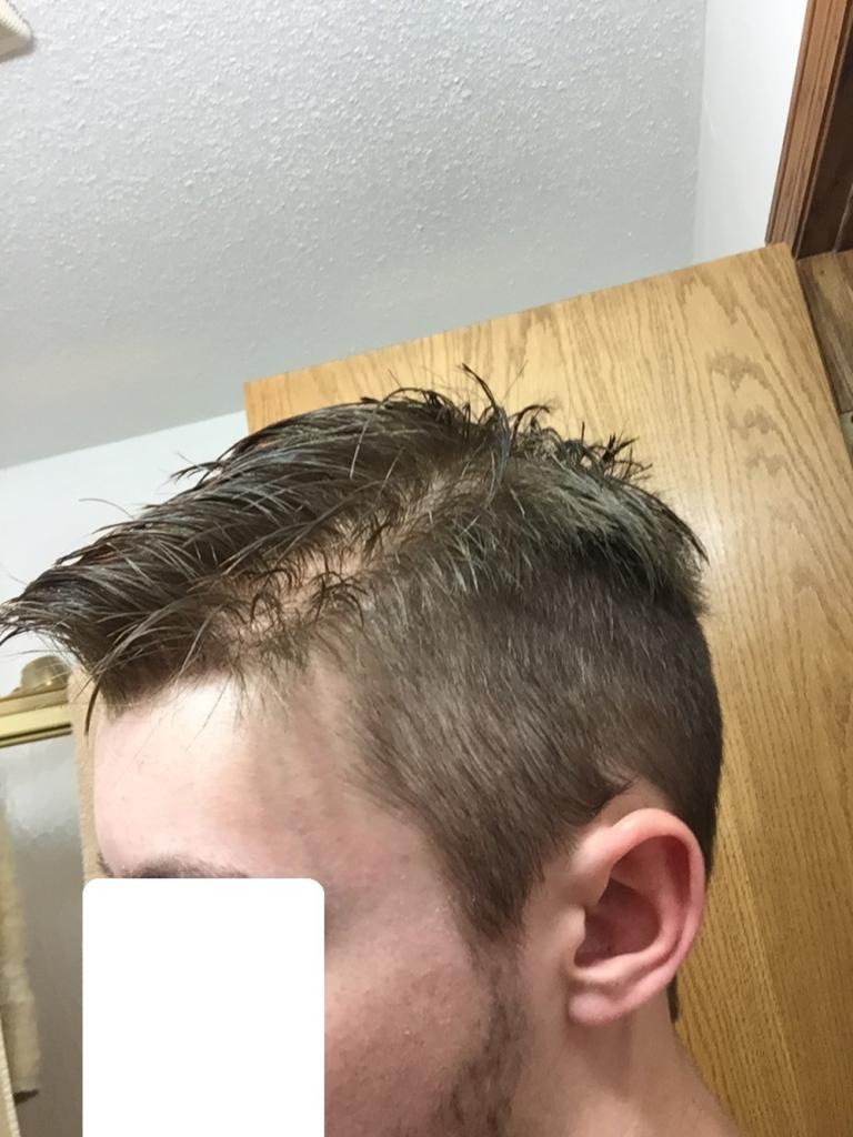 Receded.jpg