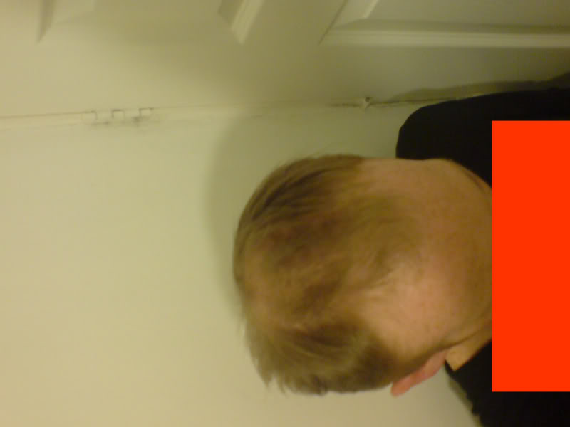 before1.jpg