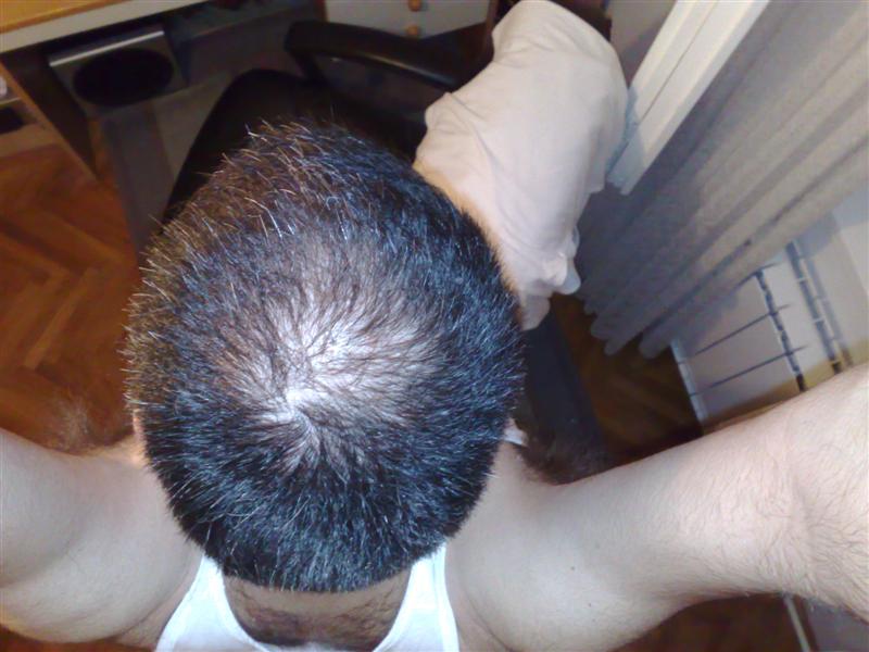 2%20months%20not%20using.jpg