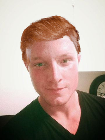 trumpbaldhurts.jpg