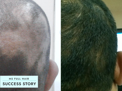 www.msfullhair.com