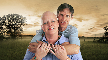 Alopecia Universalis