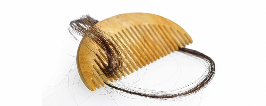 Diagnosing Alopecia Areata