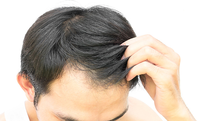 Shedding How Long