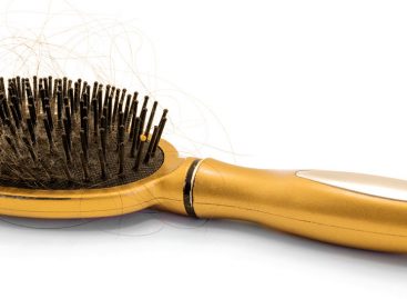 Telogen Effluvium – Why, When, and How