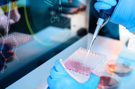 Kyocera to Begin Regenerative Hair Loss Treatment Research