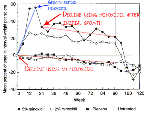 Minoxidil Long Term
