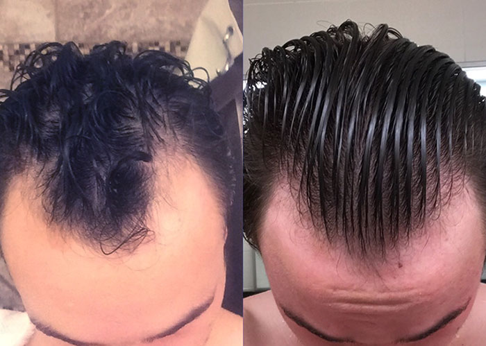 Chris Before After