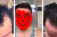 Is it Really Possible to Regrow Your Hair?  This Guy Did.