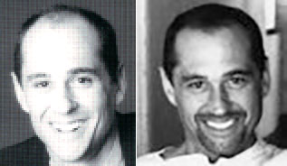 Jon Ross Before After